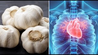 5 Miracle Cures of Garlic That Will Surprise You  Benefits Of Garlic For Your Health [upl. by Bik]