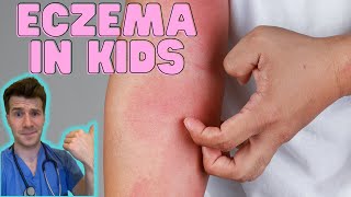 Everything you need to know about Eczema in kids Causes symptoms treatment amp home management [upl. by Mort]