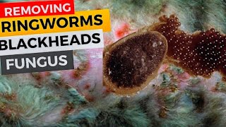 How to Remove Botfly Larva Ringworms Fungus and Blackheads on the skin of cat [upl. by Ilke334]