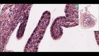 Histology of the Oviduct Fallopian Tubes 4K [upl. by Aelram]