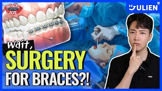 Surprising Surgeries They Do for Braces 😱 [upl. by Nosrak]