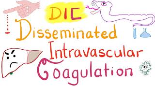 Disseminated Intravascular Coagulation DIC [upl. by Tonl]