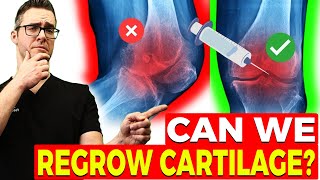 Can We Reverse Arthritis amp Regrow Cartilage New Studies [upl. by Courtland445]