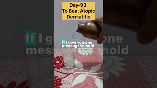 Day93 To Beat Atopic Dermatitis✅️ [upl. by Meekyh]