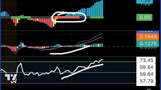 KC Trades teaches TTM Squeeze [upl. by Elitnahc293]