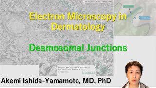 Tips for electron microscopy of desmosomal junctions [upl. by Airun482]