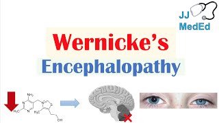 Wernicke’s Encephalopathy  Causes Symptom Triad amp Treatment [upl. by Eniamreg]