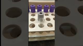 Blood Sugar test कैसे करें laboratory pathology science LabtechDTbloodtest bloodsugar viral [upl. by Gaw398]