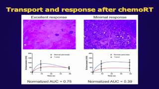 Pancreatic cancer properties describe gemcitabine response [upl. by Annaet]