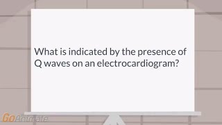 What is indicated by the presence of Q waves on an EKG [upl. by Ezara170]