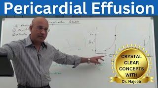 Pericardial Effusion  Pericardium  Cardiology🫀 [upl. by Eserahs439]