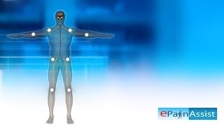 Fibromyalgia Explained Learn About 11 Tender Points Symptoms Causes of Fibromyalgia [upl. by Colver919]