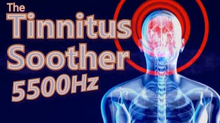 Tinnitus Soother is MidRange Focused 5500Hz Noise [upl. by Rafter]