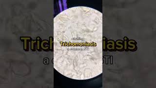 Trichomonas vaginalis 😲 urine microbiology parasite lab laboratory analysis [upl. by Coheman412]