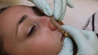 Dermaplaning facial resets your face with scalpels and acid  Glam Lab [upl. by Newman453]