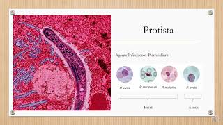 Doenças infecciosas parasitárias malária seminários 20201 [upl. by Henryk]