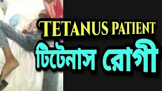 Tetanus patient  টি‌টেনাস রোগী [upl. by Herm]