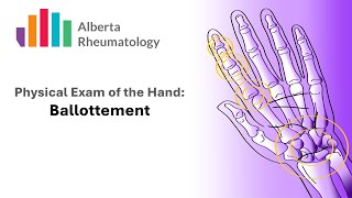 Rheumatology HAND exam Palpation for Joint Swelling [upl. by Ragg]