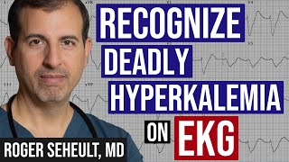 Hyperkalemia  Peaked TWaves  and ECG Recognition [upl. by Copp]