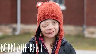 Brave 10YearOld Battles Rare Facial Tumour  BORN DIFFERENT [upl. by Fang339]