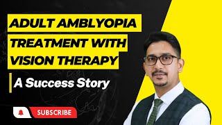 Adult Amblyopia treatment with VISION THERAPY  A Success Story [upl. by Hannej]