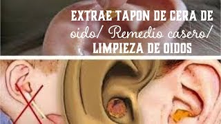 ELIMINA TAPÓN DE CERA EN OÍDOS LIMPIEZA DE OREJAS CON AGUA OXIGENADA PARA CURAR HERIDAS [upl. by Abroms]