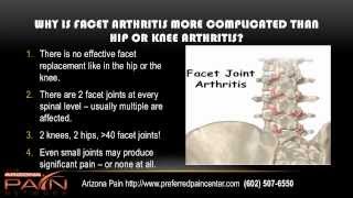 Basics of Facet Syndrome Facet Arthritis from an AZ pain clinic 602 5076550 [upl. by Berey858]