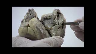 Dissection video of a sheep heart look at the right side [upl. by Althee827]