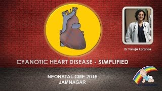 Cyanotic Heart Disease  Simplified By Dr Tanuja Karande [upl. by Otis877]