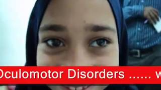 Intermittent Exotropia  الحول الوحشي المتقطع [upl. by Oba]