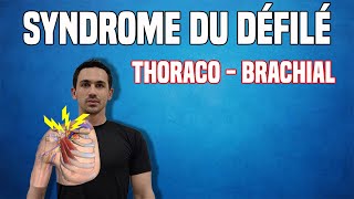 SYNDROME DU DÉFILÉ THORACOBRACHIAL  EXERCICES DE RÉÉDUCATION KINÉ [upl. by Avert]