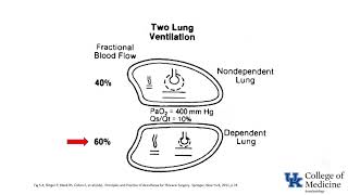 Respiratory Physiology Ventilation Perfusion Ratios  Dr Bowe [upl. by Marsh636]