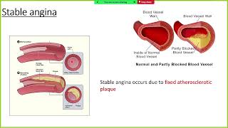 Ischemic heart diseases part 1  CVS  Medicine  Medicos Culprits [upl. by Camile569]