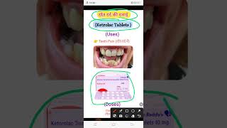 दाँत दर्द की दवाई Teeth pain Medicine indianmedicallecture youtube youtubeshorts pharmacywala [upl. by Lerad71]