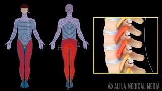 Nerve Root Block Injection Procedure Animation Video [upl. by Huai]