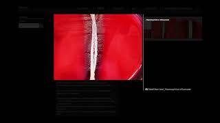 Satellitism Test  Microbiology [upl. by Solley592]