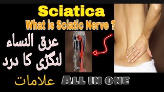 Sciatica  Sciatica Nerve Pain Causes Symptoms diagnosis  what is sciatic Nerve [upl. by Gnilyam291]