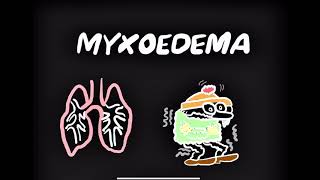 Myxoedema Coma CauseSymptoms Treatment [upl. by Kirven]