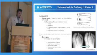 Osteocondritis y osteocondrosis [upl. by Arelc]