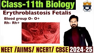 Erythroblastosis Fetalis  RH RH Blood groups  O O Blood groups [upl. by Arikihs]