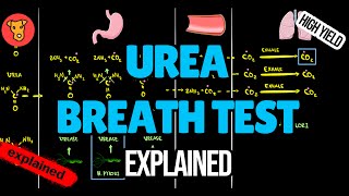 UREA BREATH TEST for Helicobacter Pylori Explained [upl. by Laeno]