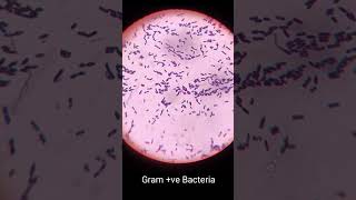 Gram Staining Results biology explore science experiment [upl. by Merton]