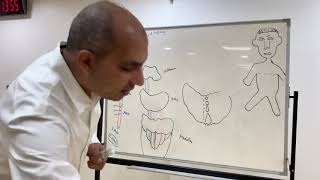 Brainstem syndromes Neuroanatomy 32 [upl. by Debo]