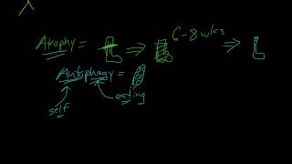 3  Introduction to Pathology  Atrophy Metaplasia [upl. by Adena]