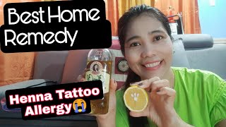 HOME REMEDY SOLUTION FOR HENNA TATTOO ALLERGY [upl. by Fawcett]