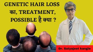 Genetic Hair Loss Treatment  Dr Satyajeet Kangle [upl. by Brenza]