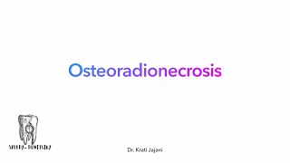 Osteo radio necrosis  the bone  the radiotherapy and the damage omfs mds cancer neetmds [upl. by Lucius692]