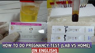 How to check pregnancy test in labDifference Between home and lab pregnancy testserum vs urine [upl. by Latt]