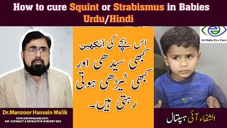 How to cure Squint or Strabismus in Babies  Urdu Hindi [upl. by Eanyl]