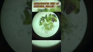 microscopic view of rhizoid scales scales slide botany botanicalart thanksforwatching [upl. by Oleusnoc]